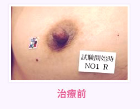 治療前