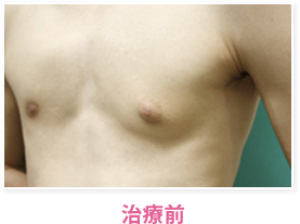 治療前