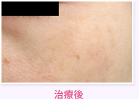 治療後