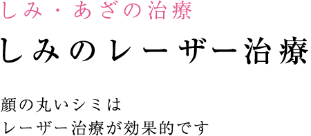 顔の円いシミは レーザー治療が効果的です
