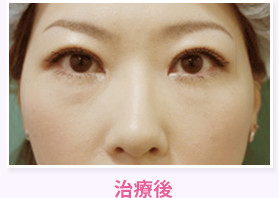 治療後