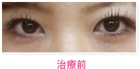 治療前