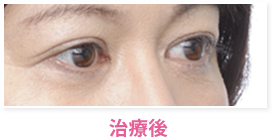 治療後