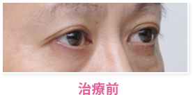 治療前