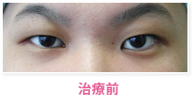 治療前