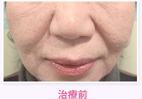 治療前