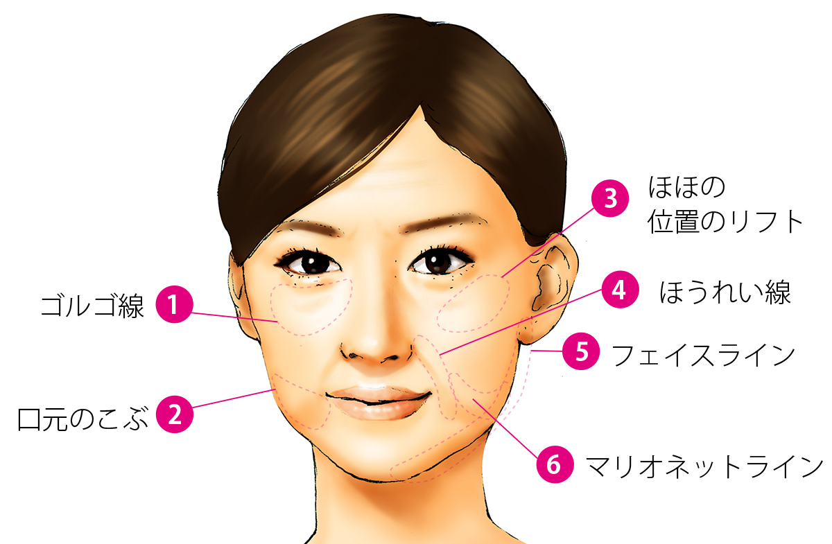 キュットリフト効果的な部位
