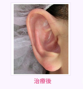 治療後