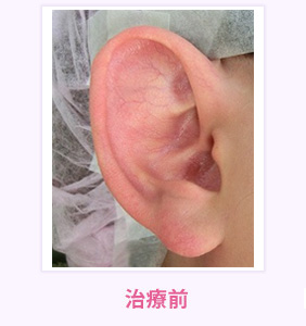治療前