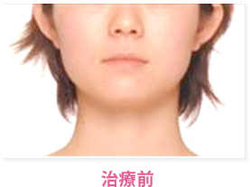 治療前