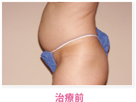 治療前