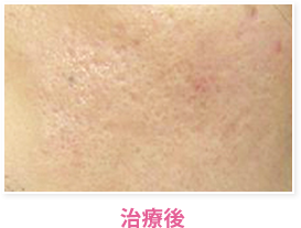 治療後