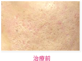 治療前