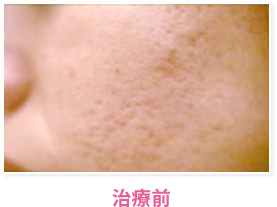 治療前
