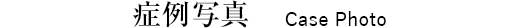 症例写真 Case Photo