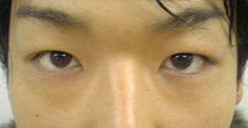 case_eye2_004_p2