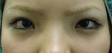 case_eye2_006