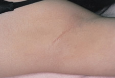 case_other2_002