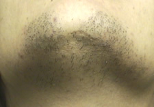 case_other2_007