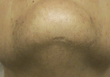 case_other2_008